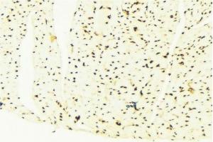 ABIN6276361 at 1/100 staining Mouse liver tissue by IHC-P. (CDKN1B anticorps  (Internal Region))
