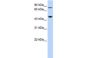 WB Suggested Anti-DPH2 Antibody Titration: 0. (DPH2 anticorps  (N-Term))