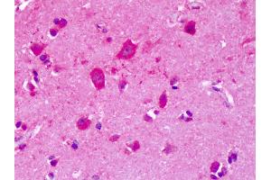 Anti-GRM8 / MGLUR8 antibody IHC of human brain, cortex.