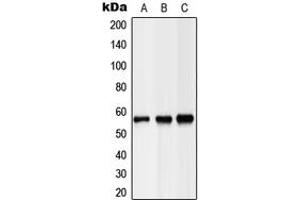 Western blot analysis of Hepatic Lipase expression in HEK293T (A), NIH3T3 (B), H9C2 (C) whole cell lysates.