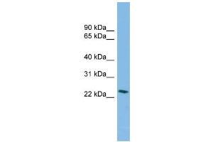 WB Suggested Anti-SSX4B Antibody Titration: 0. (SSX4B anticorps  (Middle Region))