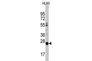 Image no. 1 for anti-Lin-28 Homolog B (LIN28B) (C-Term) antibody (ABIN357012) (LIN28B anticorps  (C-Term))