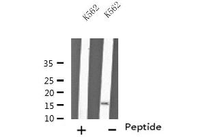 Western blot analysis of extracts from K562 cells, using MYL6 antibody.