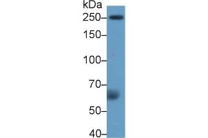 Detection of F5 in Human Serum using Polyclonal Antibody to Coagulation Factor V (F5)