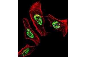 Fluorescent confocal image of Hela cell stained with NR2C2 Antibody (C-term) (ABIN1537335 and ABIN2838328). (TR4 anticorps  (C-Term))