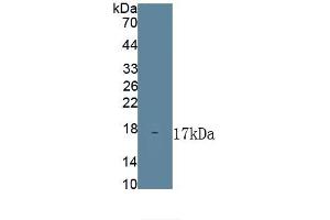 Detection of Recombinant Ferroportin, Mouse using Polyclonal Antibody to Ferroportin (FPN) (SLC40A1 anticorps)