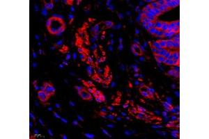 Immunofluorescence of paraffin embedded rat breast using LRP (ABIN7074548) at dilution of 1: 250 (400x lens)