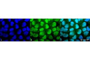 Immunocytochemistry/Immunofluorescence analysis using Rabbit Anti-Methylated Lysine Polyclonal Antibody . (Lysine (lys) (methylated) anticorps (Biotin))
