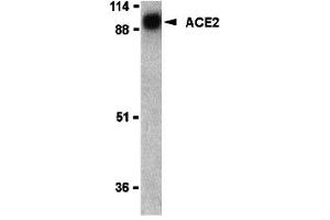 Western Blotting (WB) image for anti-Angiotensin I Converting Enzyme 2 (ACE2) (N-Term) antibody (ABIN1031210) (ACE2 anticorps  (N-Term))