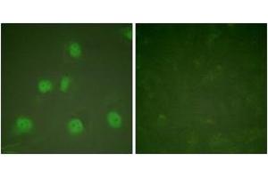 Immunofluorescence analysis of HeLa cells, using Cullin 1 Antibody. (Cullin 1 anticorps  (AA 727-776))
