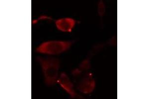 ABIN6277002 staining Hela cells by IF/ICC. (TBXAS1 anticorps  (N-Term))