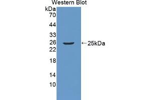 Detection of Recombinant RGS5, Mouse using Polyclonal Antibody to Regulator Of G Protein Signaling 5 (RGS5) (RGS5 anticorps  (AA 1-181))