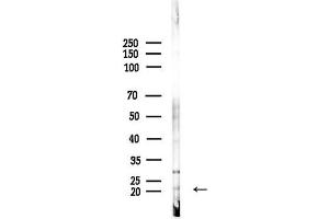 anti-Calcium And Integrin Binding Family Member 2 (CIB2) (Internal Region) antibody