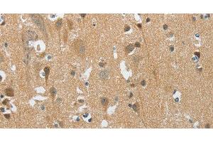 Immunohistochemistry of paraffin-embedded Human brain tissue using PITX3 Polyclonal Antibody at dilution 1:40