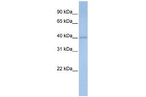 PDSS1 antibody used at 1 ug/ml to detect target protein.