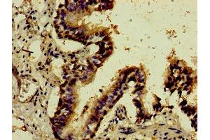 Immunohistochemistry of paraffin-embedded human lung tissue using ABIN7148789 at dilution of 1:100
