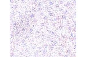 Immunohistochemistry of PLXDC1 in mouse liver tissue with PLXDC1 polyclonal antibody  at 2. (PLXDC1 anticorps  (C-Term))