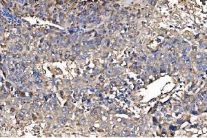 IHC analysis of HMGCS2 using anti-HMGCS2 antibody (ABIN7599435). (HMGCS2 anticorps  (AA 1-487))