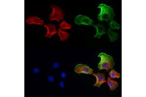 ABIN6259812 and ABIN6272986 staining Hela cells by IF/ICC. (ADRM1 anticorps  (Internal Region))