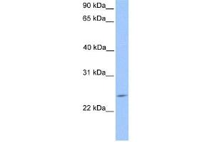 WB Suggested Anti-PTTG2 Antibody Titration:  0. (PTTG2 anticorps  (Middle Region))