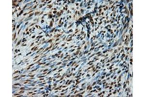 Immunohistochemical staining of paraffin-embedded liver tissue using anti-PSMC3 mouse monoclonal antibody. (PSMC3 anticorps)