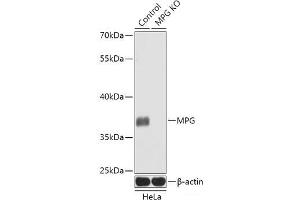 Western blot analysis of extracts from normal (control) and MPG knockout (KO) HeLa cells using MPG Polyclonal Antibody at dilution of 1:1000. (MPG anticorps)