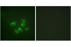 Immunofluorescence analysis of HepG2 cells, using Tryptophan Hydroxylase (Ab-58) Antibody.