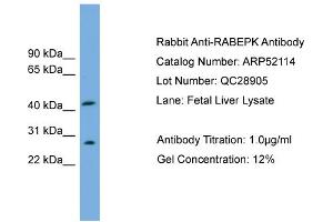 WB Suggested Anti-RABEPK  Antibody Titration: 0. (RABEPK anticorps  (N-Term))
