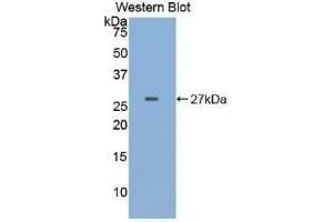 Detection of Recombinant EGFR2, Mouse using Polyclonal Antibody to Receptor Tyrosine Protein Kinase erbB-2 (ErbB2)