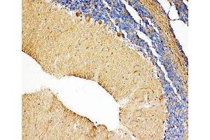 IHC-P: NME2 antibody testing of rat cerebellum tissue