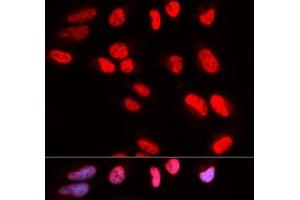 Immunofluorescence analysis of U2OS cells using PRPF3 Polyclonal Antibody (PRPF3 anticorps)