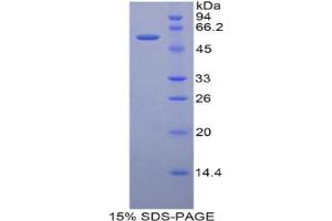 SDS-PAGE analysis of Rat CUZD1 Protein. (CUZD1 Protéine)
