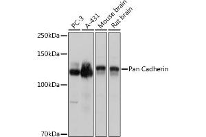 Western blot analysis of extracts of various cell lines, using Pan Cadherin antibody (ABIN7266233) at 1:3000 dilution. (CDH1,CDH2,CDH3,CDH4 (AA 800-882) anticorps)
