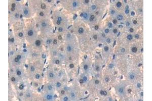 Detection of IL33 in Human Liver Tissue using Monoclonal Antibody to Interleukin 33 (IL33)