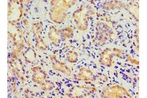 Immunohistochemistry of paraffin-embedded human kidney tissue using ABIN7146745 at dilution of 1:100 (CBR3 anticorps  (AA 118-277))