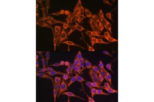 Immunofluorescence analysis of HeLa cells using MT- antibody (ABIN7268594) at dilution of 1:100. (Mitochondrially Encoded ATP Synthase 8 (MT-ATP8) anticorps)