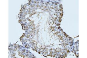IHC analysis of GHITM using anti-GHITM antibody (ABIN7599294). (GHITM anticorps  (AA 1-345))