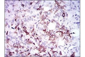 Immunohistochemistry (IHC) image for anti-Secreted phosphoprotein 1 (SPP1) (AA 167-314) antibody (ABIN1845756)