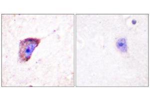 Immunohistochemistry (IHC) image for anti-Tyrosine Hydroxylase (TH) (pSer19) antibody (ABIN1847228) (Tyrosine Hydroxylase anticorps  (pSer19))