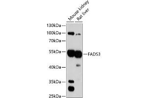 Western blot analysis of extracts of various cell lines, using F antibody (ABIN1679802, ABIN3018325, ABIN3018326 and ABIN6220437) at 1:3000 dilution. (FADS3 anticorps  (AA 1-130))