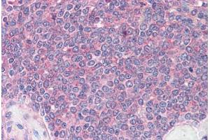 Spleen: Formalin-Fixed, Paraffin-Embedded (FFPE) (DDX3X anticorps  (Internal Region))