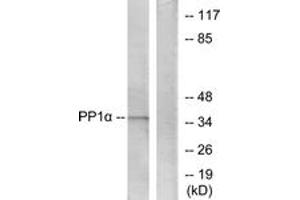 Western Blotting (WB) image for anti-Protein Phosphatase 1, Catalytic Subunit, alpha Isoform (PPP1CA) (AA 281-330) antibody (ABIN2888749) (PPP1CA anticorps  (AA 281-330))