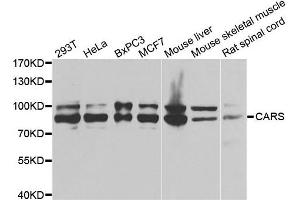 Western blot analysis of extracts of various cell lines, using CARS antibody. (CARS anticorps)