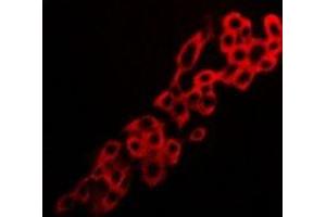 Immunofluorescent analysis of Adenosine A2a Receptor staining in LOVO cells. (Adenosine A2a Receptor anticorps  (C-Term))