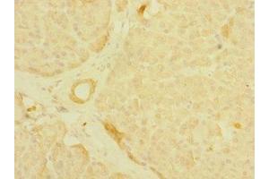 Immunohistochemistry of paraffin-embedded human pancreatic tissue using ABIN7158910 at dilution of 1:100 (MPP6 anticorps  (AA 220-420))