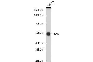 Western blot analysis of extracts of Rat eye cells, using SAG antibody (ABIN6132558, ABIN6147361, ABIN6147362 and ABIN6216887) at 1:1000 dilution.
