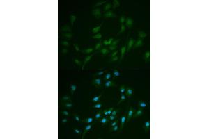 Immunofluorescence analysis of MCF7 cell using LIG1 antibody. (LIG1 anticorps)