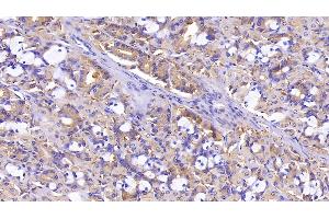 anti-PDZ and LIM Domain 1 (PDLIM1) (AA 2-329) antibody
