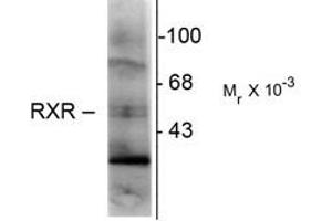 Image no. 1 for anti-Retinoid X Receptor, gamma (RXRG) antibody (ABIN303926) (Retinoid X Receptor gamma anticorps)
