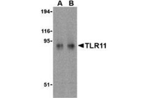 Western blot analysis of TLR11 in RAW264. (TLR11 anticorps  (C-Term))
